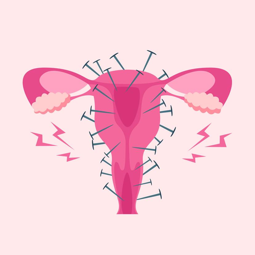 Illustration of a uterus with nails and bolts around it to represent menstrual pain